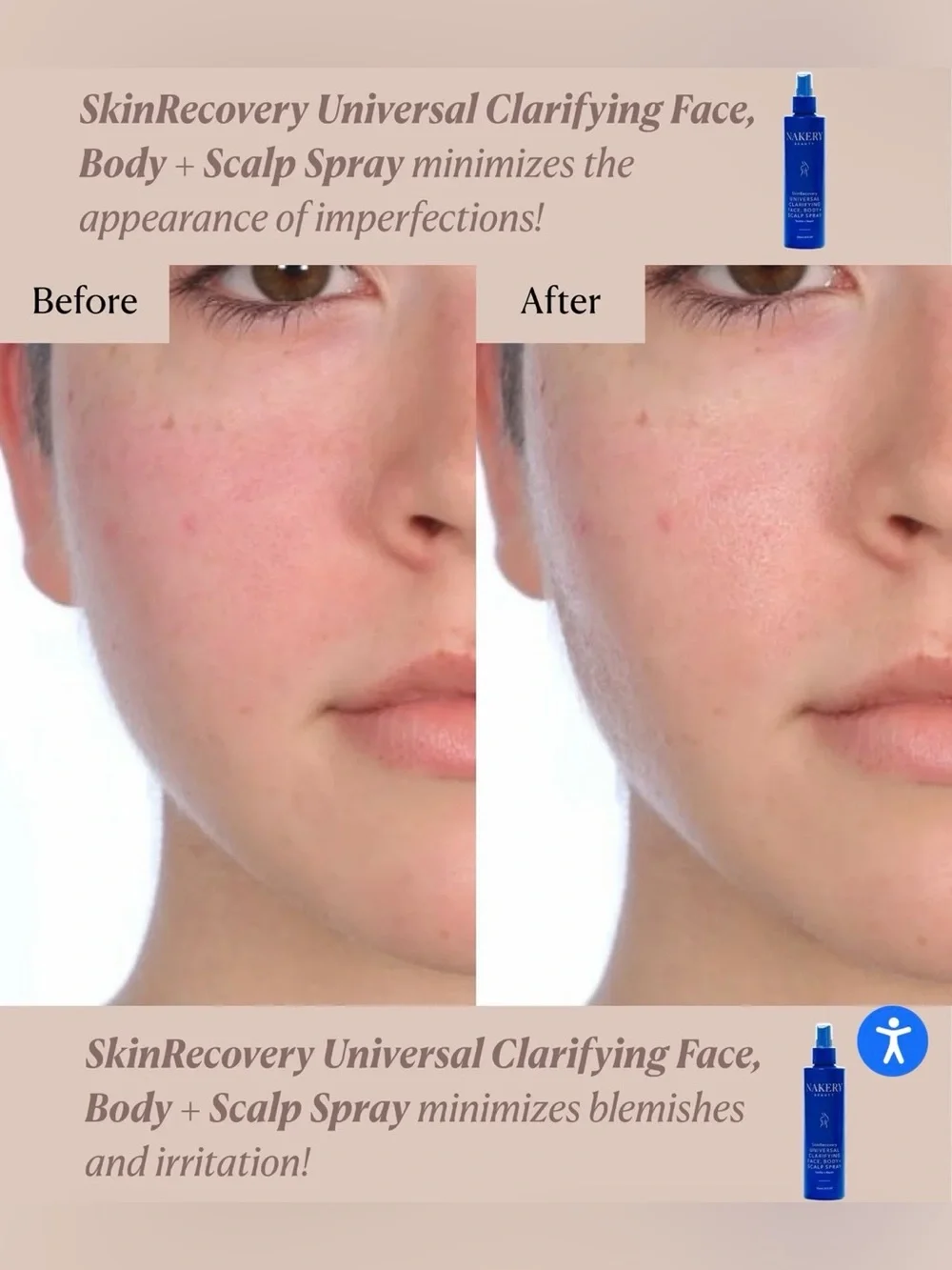NAKERY BEAUTY SkinRecovery Universal Clarifying Face Body + Scalp Spray 8 oz